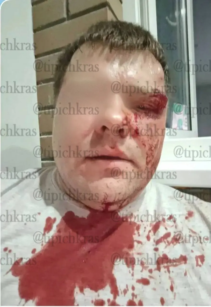 Во дворе жилого комплекса в поселке Северный компания подростков напала на мужчину после конфликта; по словам жены пострадавшего, инцидент начался после её замечания им.